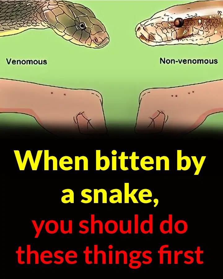 When bitten by a snake, you should do these things first