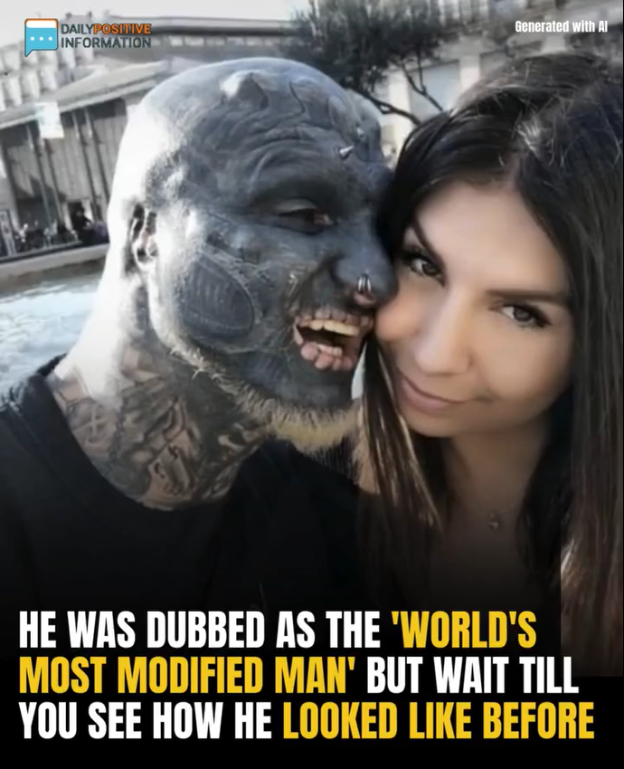 He Was Dubbed As The ‘World’s Most Modified Man’ But Wait Till You See How He Looked Like Before